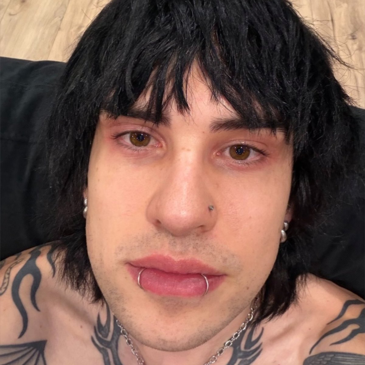 just found out u can be allergic to lash serum