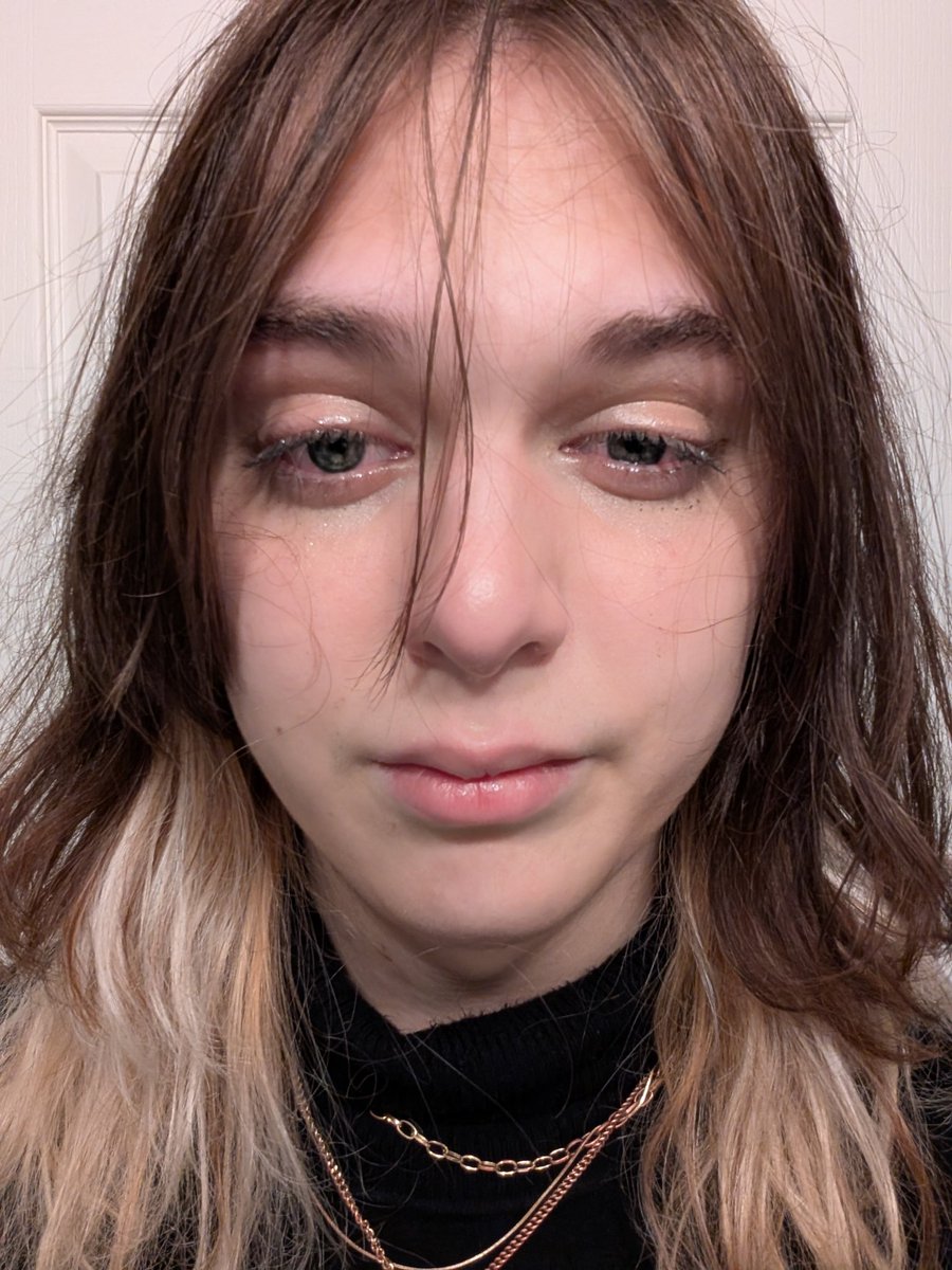 kliss🍓🏳️‍⚧️ tweet media