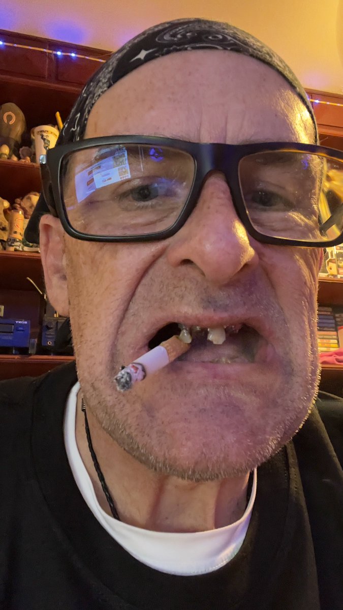 smilindesporado's tweet image. This is what the fire safety chemical dip has done to my teeth , thank you #potus43, #potus44, an now it’s harder to quit now because the cigarette dip makes it like crystal meth addiction, and I can’t sue because of what you signed potuses ,