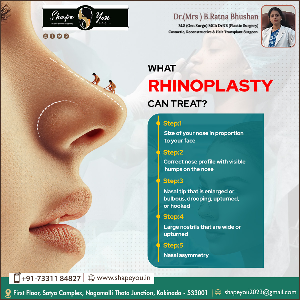 shapeyouclinic's tweet image. What Can Rhinoplasty Treat?

📞: 7331184827
🌐 : shapeyou.in
✉️ : shapeyou2023@gmail.com

#Rhinoplasty #NoseJob #CosmeticSurgery #PlasticSurgery #NoseReshaping #FacialAesthetics #NoseCorrection #NasalTipCorrection #NoseHumpCorrection #ShapeYouClinic #drratnabhushan