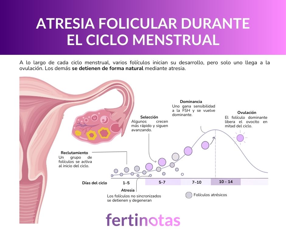🟣 La mayoría de los folículos nunca llegará a ovular.
🟣 Solo 300–500 lo hacen en toda una vida.
No es un fallo: es la naturaleza del ovario.
Descubre cómo funciona este proceso fascinante en nuestro nuevo artículo.

fertinotas.com/atresia-folicu…
#atresiafolicular #saludreproductiva