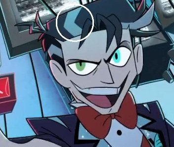 that part is totally hinting at gray hairs