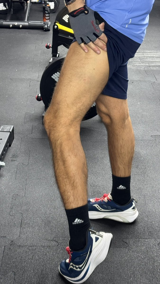 Moin
erstmal wieder dem Betreiber geschrieben weil die Jugend hier meint das Gym sei ein Abenteuerspielplatz. Kein Anstand keine Rücksicht nur Chaos.
Egal
Rückentag wartet
und mein Bein wird nach dem Sturz kaum blau
scheinbar haben selbst Blutergüsse inzwischen kein Bock auf mich