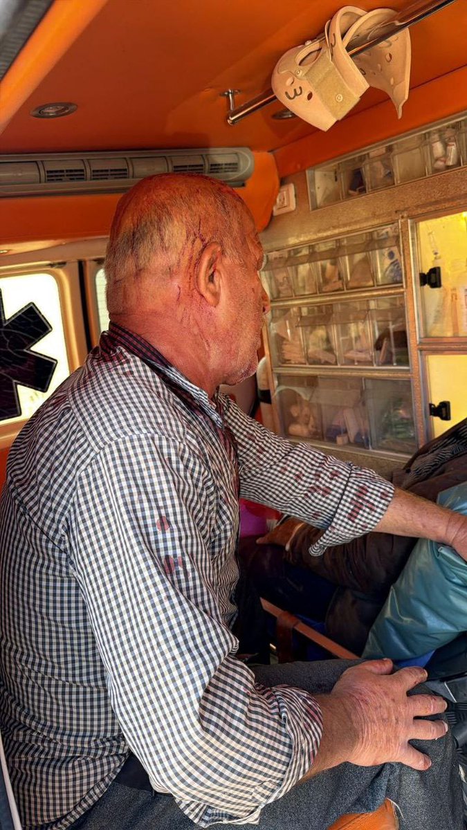 QudsNen's tweet image. Israeli settler militias attacked Palestinian farmers near the town of Beit Lid, north of Tulkarm, in the occupied West Bank.