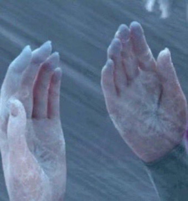 اطراف اللي عندهم فقر دم بالشتاء