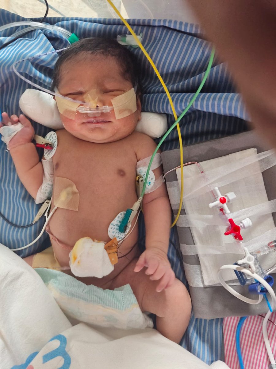 Ponnipoiyamozh1's tweet image. இந்த புகைப்படத்தில் இருக்கும் குழந்தை என் நண்பரின் சகோதரியின் குழந்தை 🥹மருத்துவ உதவி தேவைப்படுகிறது 🙏தங்களால் முடிந்த உதவியை இந்த எண்ணுக்கு அனுப்புங்கள் 🙏 Vinupriya.R
6374576958
(Karthick ram Harivaasan)