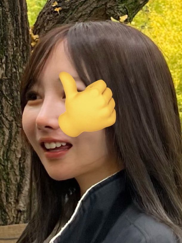 17dsy_'s tweet photo. 【脂肪吸引の執刀医決める時必ず見るべき7選】

・吸引量と“どの層を吸うか”を説明してくれるか
（浅層だけ吸うと凸凹になる）
・カニューレの太さと本数、傷の位置まで具体的に教えてくれるか
・術後圧迫・マッサージ・拘縮の説明がリアルかどうか
・体質的に“吸引しても痩せにくい部位”を正直に伝えるか
・症例写真の加工・フィルターの有無が明確か
・総額見積もりに麻酔・圧迫具・薬代・再診料が含まれているか

私は脂肪溶解で数十万ドブった後に、やっと全部クリアする所に出会った。