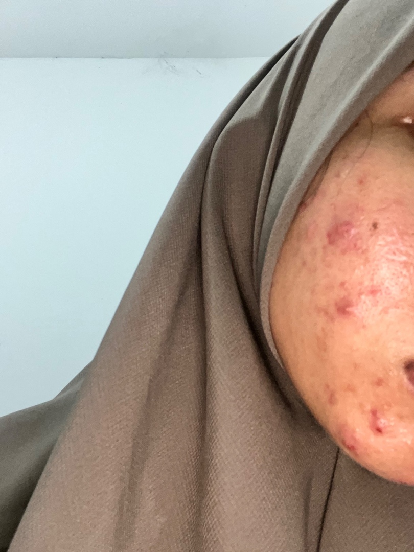 ✨OMBB | 🚫NO LINK tweet media