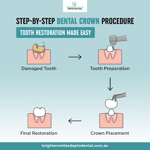 DaptoDental's tweet image. Fix It, Don’t Hide It – Restorative Treatments That Bring Back Your Smile.

Explore all our restorative dental services:
 brightersmilesdaptodental.com.au/services/

#BrighterSmilesDapto #RestorativeDentistry #FixYourSmile #DentalCrowns #DentalFillings #DentalImplants #HealthyTeethHealthyLife