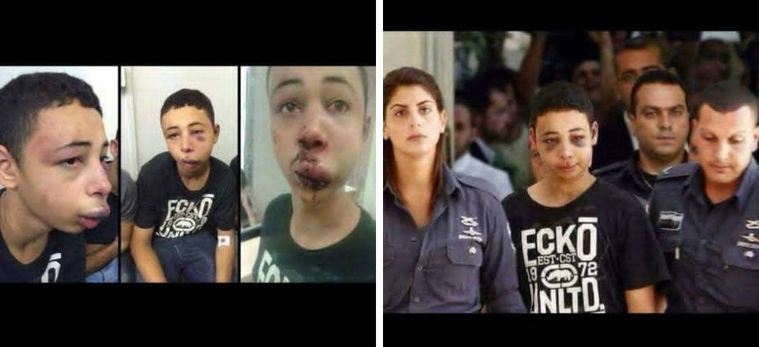 safaa_t0o's tweet image. الأسير الطفل طارق ابو خضير خلال عرضه على المحكمة مع ظهور علامات التعذيب على وجهه ..

لو كان هذا الطفل في بلد آخر لعرضت صوره على شاشات التلفزة في جميع أنحاء العالم ولكانت جميع المنظمات التي تدعي حقوق الإنسان والأطفال بالتحديد قد أقامت الدنيا ولم تقعد ولكان مجلس الأمن قد اجتمع من…