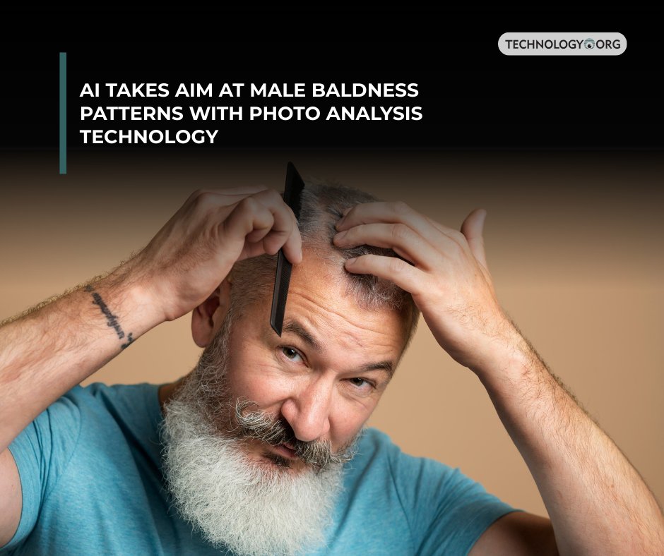TechnologyOrg's tweet image. Cyriac Lefort, 32, sat in a New York salon when his stylist mentioned thinning hair. The observation related to potential baldness launched him into a sprawling investigation of the hair restoration business

Full article: technology.org/2025/11/27/ai-…
 
#ai #balding #technology