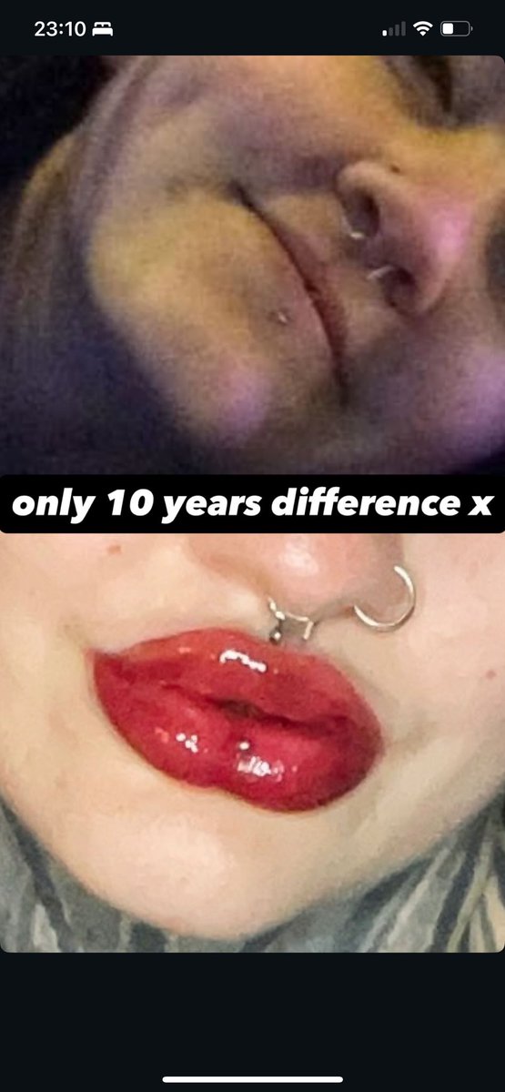 we love the lip evolution