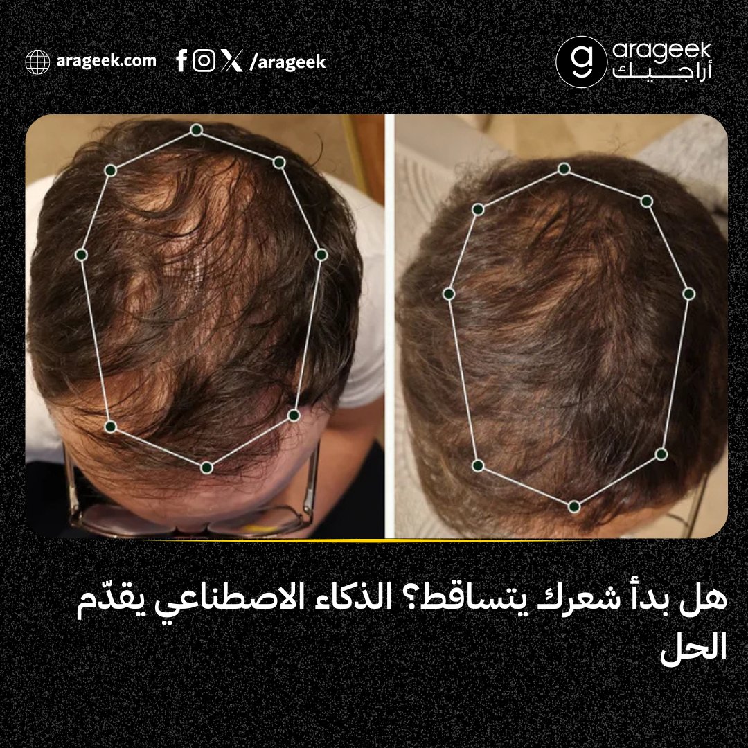 تطبيق MyHair AI يستخدم صور فروة الرأس لتحليل تساقط الشعر وربط المستخدمين بأطباء وخطط علاجية مبنية على بيانات حقيقية لا وعود تسويقية.
📌 التفاصيل: rfr.bz/t64053f
