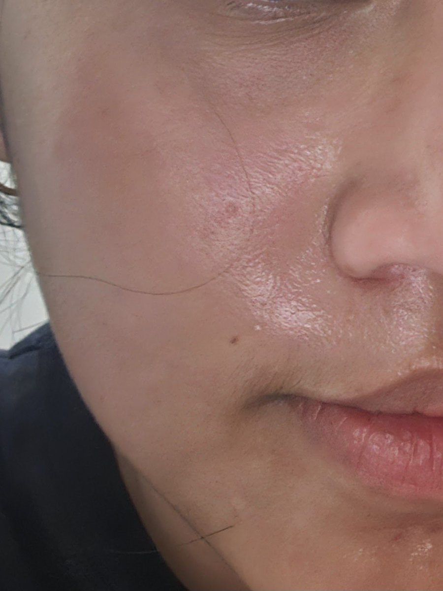 hmtly's tweet image. please BACK TO BASIC! it’s repair your skin barrier so well &amp;lt;3