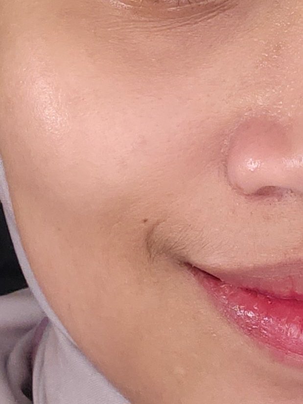 hmtly's tweet image. please BACK TO BASIC! it’s repair your skin barrier so well &amp;lt;3