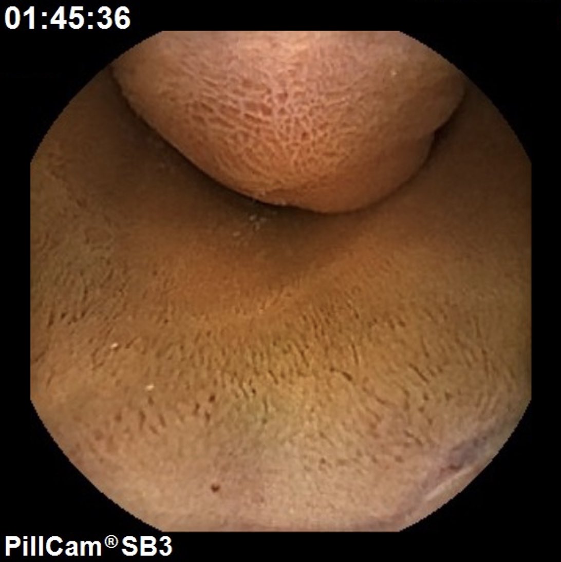 Ignacio Fernández-Urién tweet media