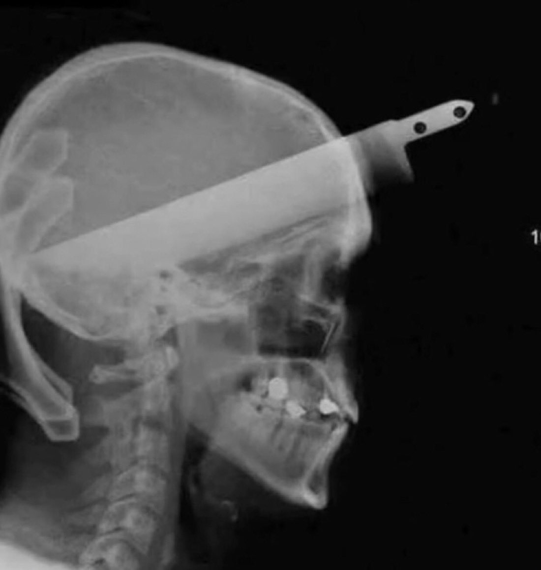 everslay13's tweet image. what lyric felt like this first time hearing it