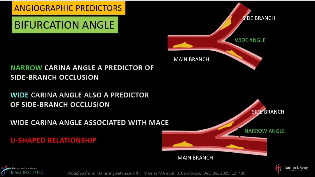Zill_cardio's tweet photo. #BifurcationPCI
What are the Angiographic Predictors for Side Branch Occlusion during PCI❓️
✅️ 📐 of SB
✅️ Severity of SB dis
✅️ Location of SB dis
✅️ ⬆️ MV : SB dia. ratio
✅️ Plaque burden at Bifurcation core
✅️ Plaque distribution
#COMPLEXPCI2025 @summitmd_cvrf https://t.co/alvb7Q09BO
