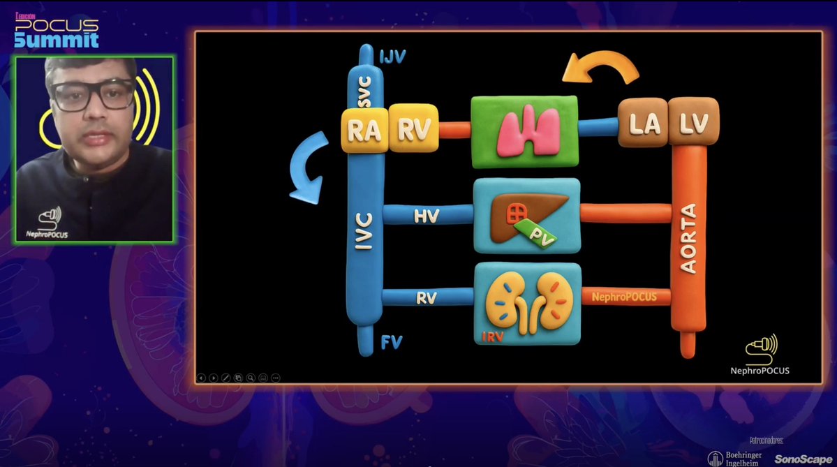 Volume intolerance is the hemodynamic expression of elevated cardiac filling pressures. Brilliantly explained by <a href="/NephroP/">NephroPOCUS</a> in the #pocusummit: when the heart right or left, struggles to accommodate preload, RAP (right side) and LVEDP (left side) can rise, leading to venous