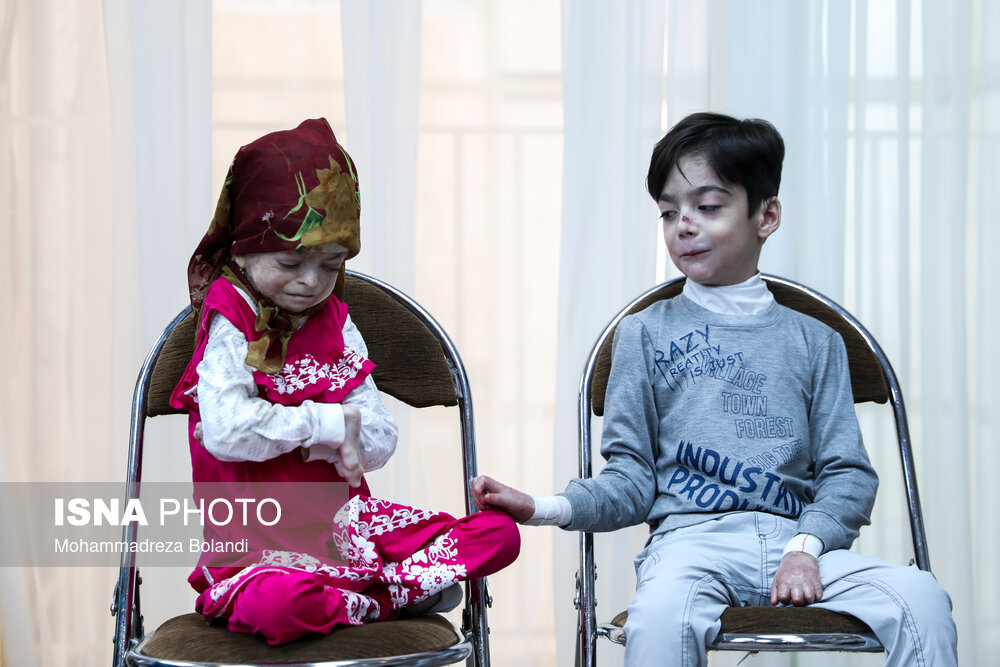 IranFrontPage's tweet image. Iranian firm ready to mass-produce advanced dressings for EB patients, awaits institutional support ifpnews.com/iranian-firm-r…