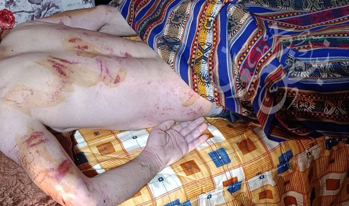 AbujomaaGaza's tweet image. Israeli occupation forces have attacked and beaten this Palestinian in Tammoun neighbourhood of the occupied West Bank city of Tubas.