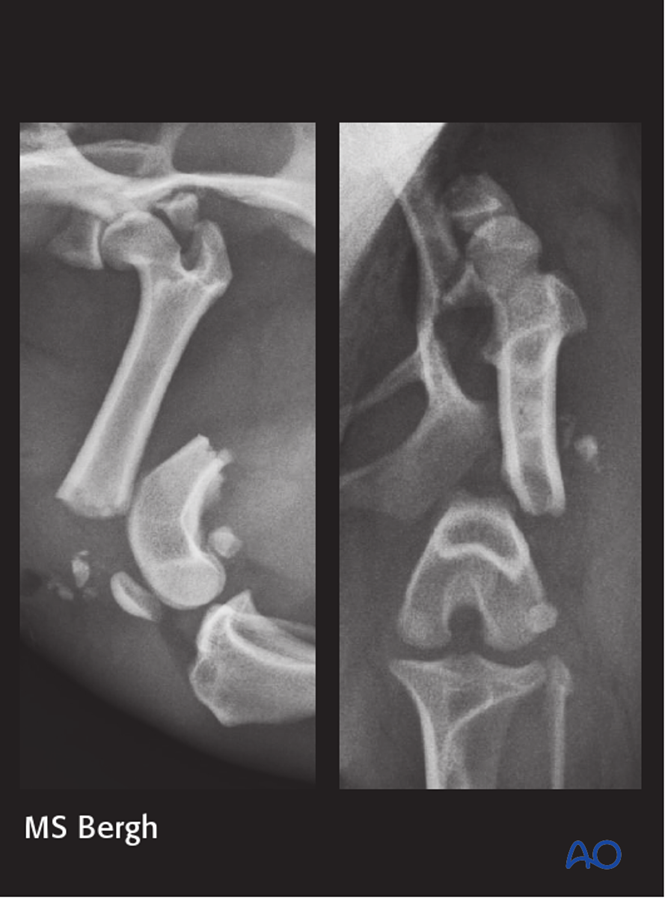 AO Surgery Reference tweet media