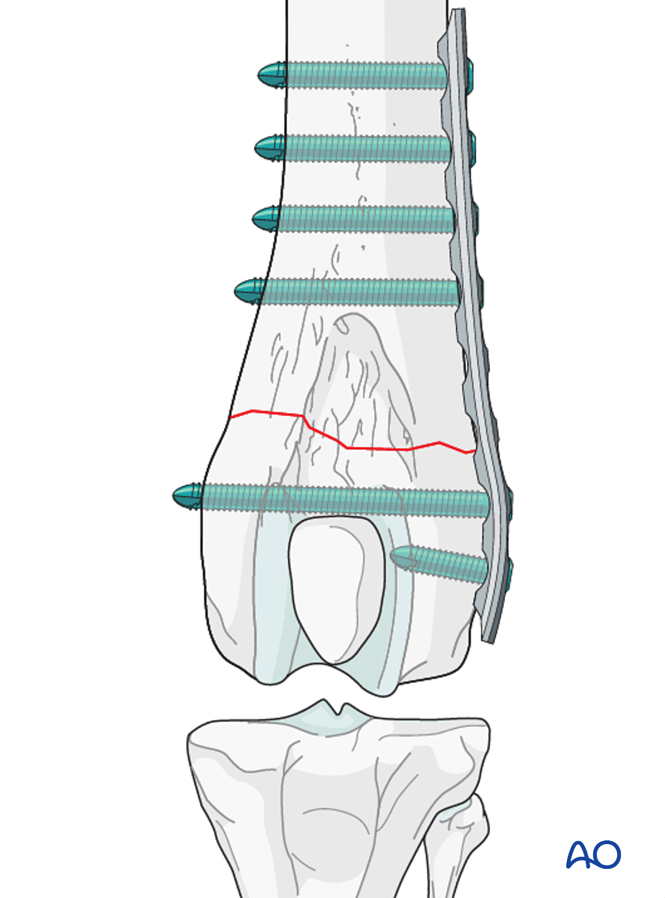 AO Surgery Reference tweet media