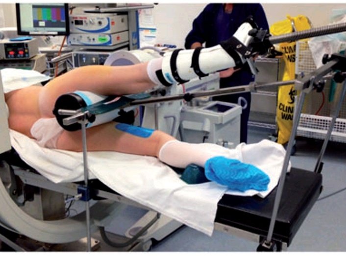 myfight2beheard's tweet image. The #PerinealPost, #Mesh and #hysteroscopy are ALL barbaric devices that MUST be banned.

No patient should be left traumatised and with a brand new, worse injury through having a non-urgent surgery or procedure.

These dangerous devices have been known by the medical world to…