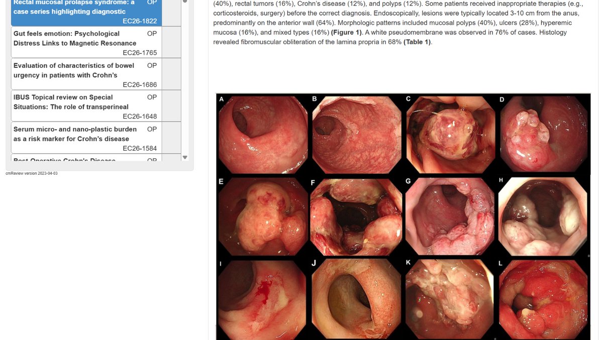 On the way 🚆to next Masterclass with #UEGW 💚

As every year, fascinating &amp; informative reports to review at #ECCO 2026💙

And it all revolves around <a href="/IBD/">| 🐆</a>😍🥰😍

UEG Masterclass in IBD, Vienna 🇦🇹 2025
ECCO Congress, Stockholm 🇸🇪 2026

<a href="/my_ueg/">United European Gastroenterology</a>  <a href="/Y_ECCO_IBD/">Y-ECCO</a> 
<a href="/YOGI_IBD/">YOGI_IBD</a> <a href="/ESGE_news/">ESGE</a>