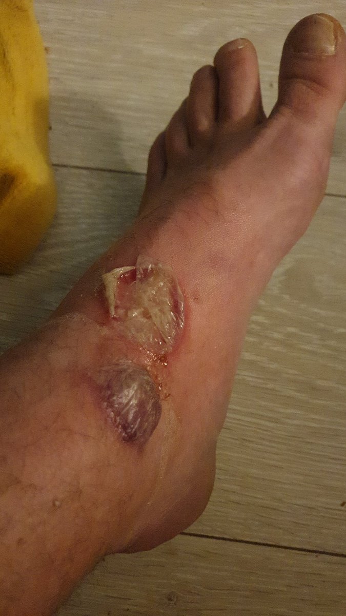 My Pilot tweet media