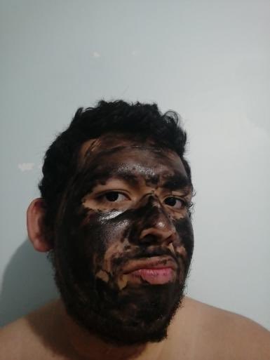 #FuerzaMiguel

Ayuda a miguel: CONTEXTO DE #FuerzaMiguel
este es miguel un joven tiktoker de 21, lamentablemente tuvo un accidente en un bus cerca a Av. proceres en san juan de lurigancho y todos sus amigos estamos poniendo #FuerzaMiguel que sigue recuperandose en el hospital...