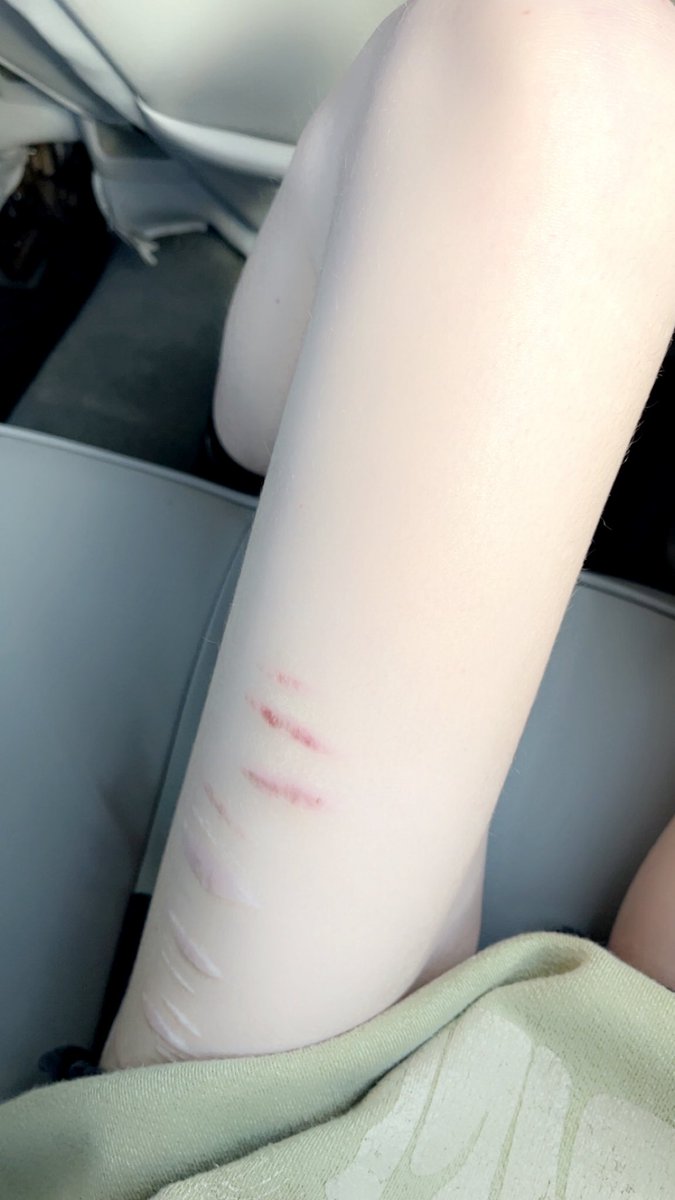 luvcreeps's tweet image. snorted 2 lines and then hopped my jolly ass into the car to go to thanksgiving dinner girl Wtf #shedtwt #edtwt