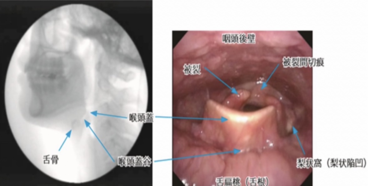 119回歯科医師国家試験対策 ロムニーハウス勉強会【講師 Dr.N