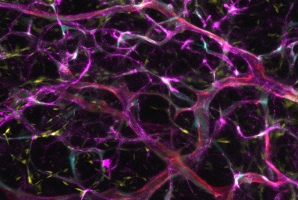 BiomatNet's tweet image. News 
Galvanizing Blood Vessel Cells to Expand for Organ Transplantation
news.weill.cornell.edu/news/2025/10/g…
#news #science 
#bioengineering #biomedical #biotechnology #cells #regenerativemedicine #tissueengineering #tissueregeneration