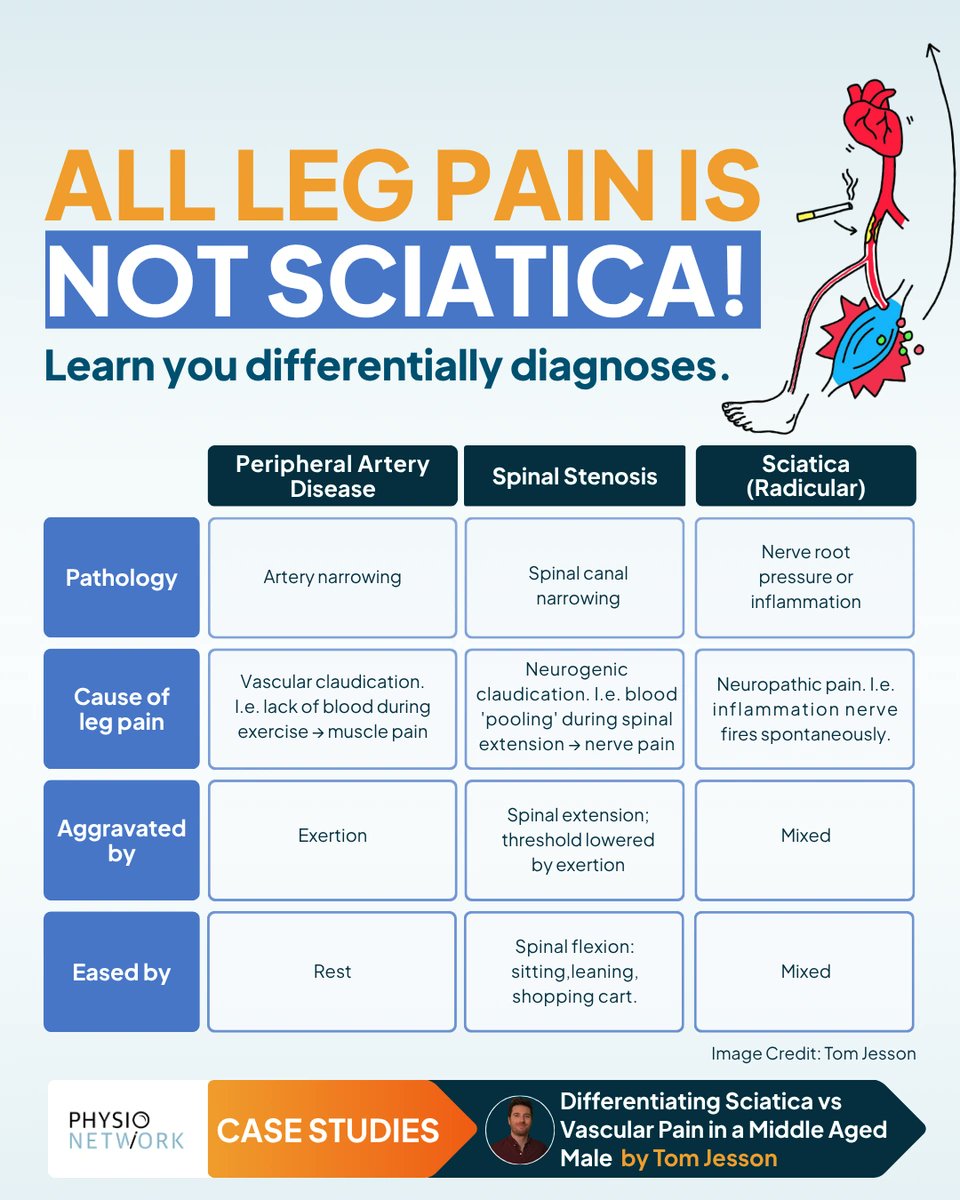 PhysioNetwork's tweet image. ⚡️ Could that “sciatica” actually be something else?

Don’t risk missing a crucial diagnosis like peripheral artery disease, it can look deceptively similar.

Tom Jesson&apos;s case study is essential learning.

✅ Watch for FREE with you