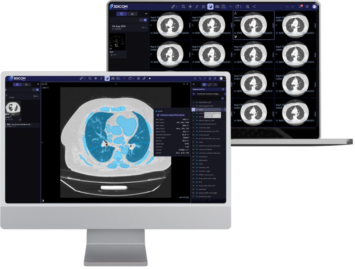 Singular Health has submitted its 510(k) to the FDA for 3DICOM MD™ Cloud — expanding imaging capability, improving clinical workflows and strengthening its cloud-based, AI-ready platform. Full ASX ann 🔗 bit.ly/4opodhB
$SHG  #interoperability #AI #duplicateimaging