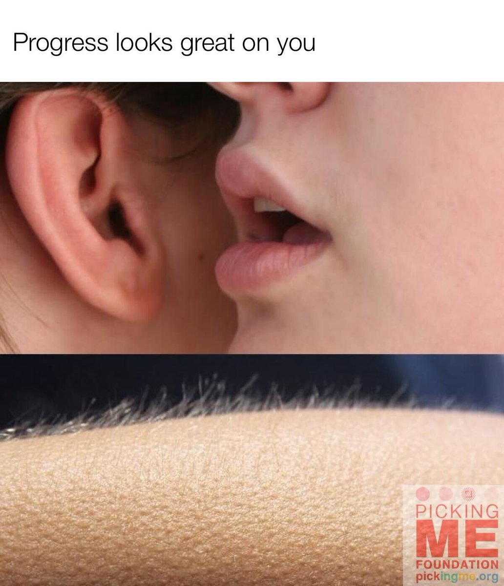 Looking to meet members of the #SkinPickingDisorder community who understand?

Join us at Picking Me Con from May 8 - 10, 2026 in Chicago!
Come connect with those with lived-experiences, providers and supporters for an unforgettable weekend of advocacy!

pickingme.org/con