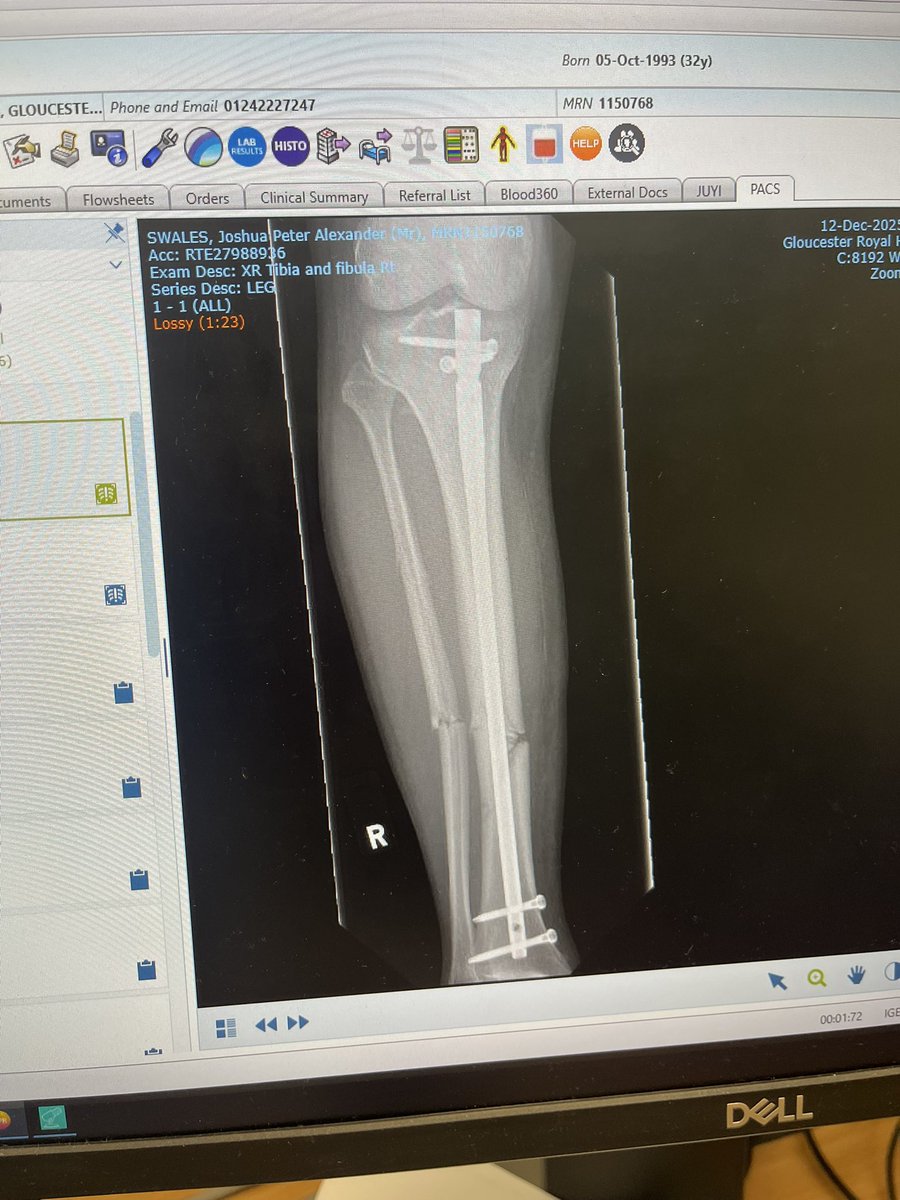 Josh Swales tweet media