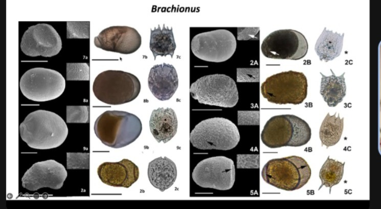 oikossokio's tweet photo. On December 11, 2025, Dr. Gerardo Guerrero-Jimenez presented his interesting and promising advances in research on the morphology and ultrastructure of the resting eggs of rotifers and cladocerans. In the Network of Neotropical Zooplankton, we appreciate his kindness in sharing his findings with our Network. @NeolimnosRCL @AB_limno   @aslo_org @SIL_limnology @SFSLatinChapter