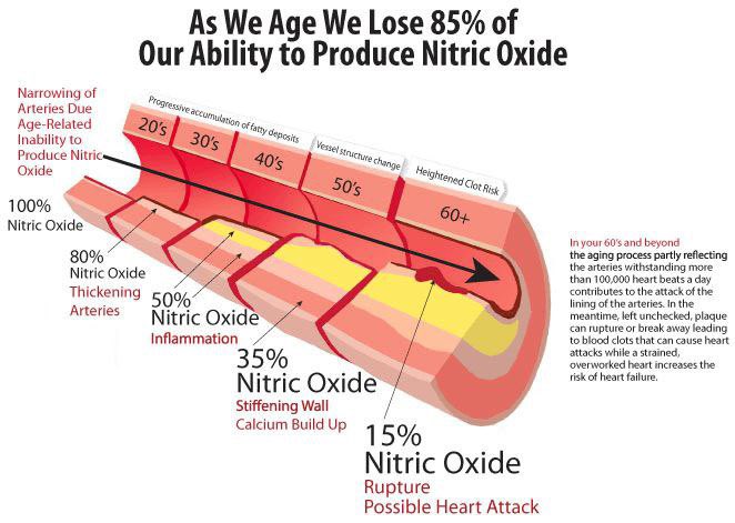 Fix #4: Improve nitric oxide (NO) levels NO is the key molecule for ...