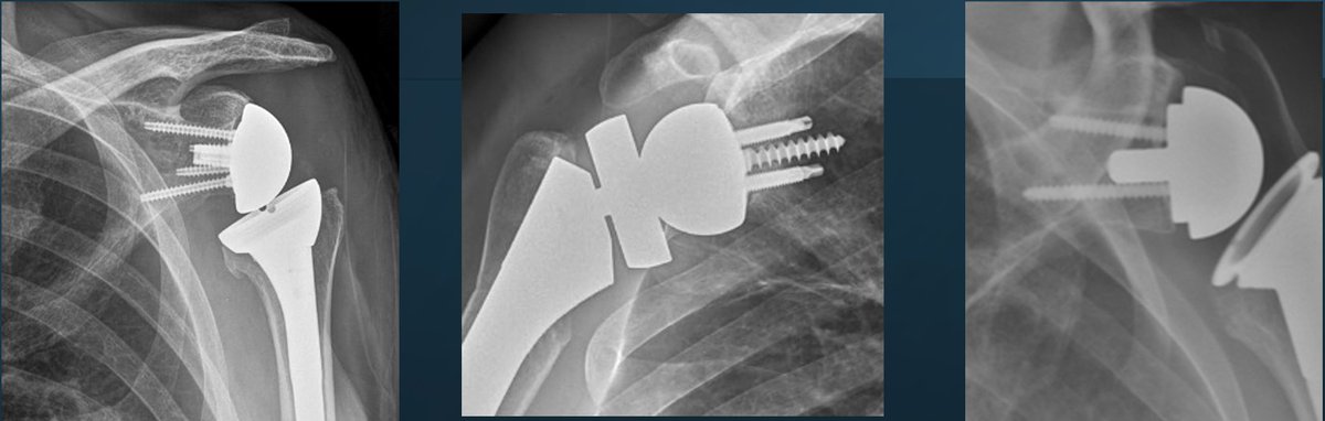 Rick Matsen tweet media