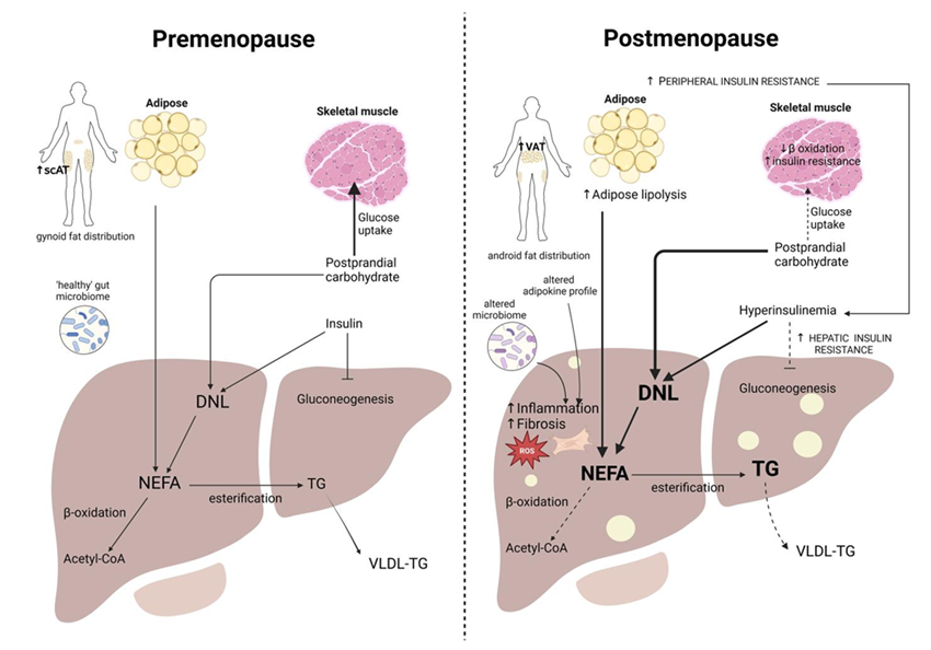 📢The Impact of Estrogen Deficiency on Liver Metabolism: Implications for Hormone Replacement Therapy

✍️La enfermedad hepática esteatótica asociada a disfunción metabólica  es la enfermedad hepática crónica más común a nivel mundial

academic.oup.com/edrv/article/4…
<a href="/GrupoGIDSEEN/">GRUPO GIDSEEN</a>