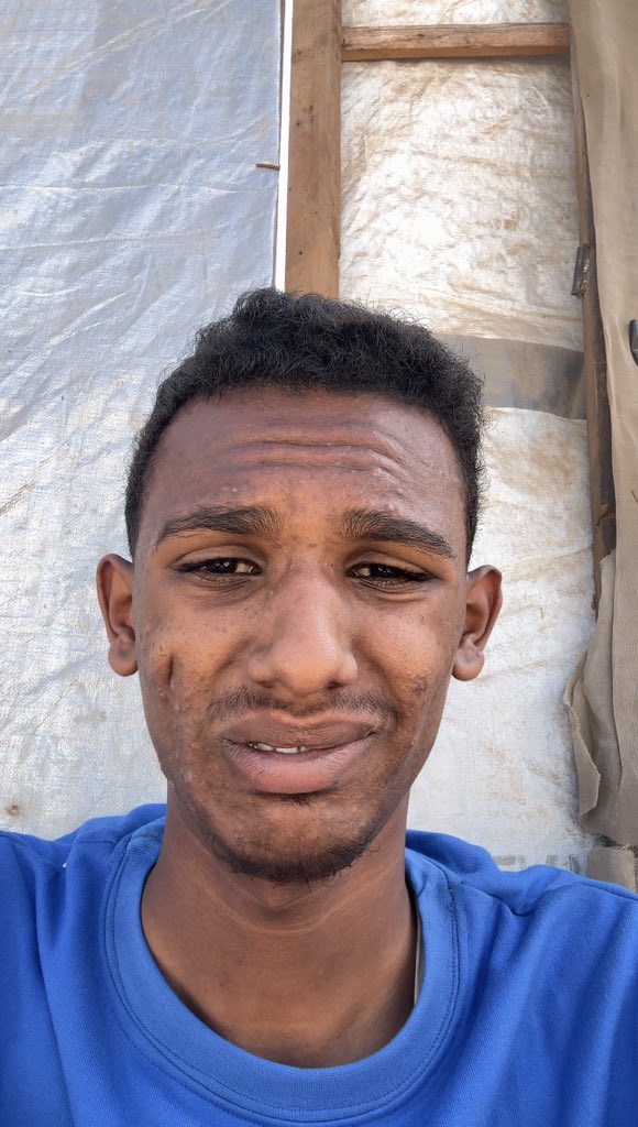 Hey world,

My name is ismail obaid. It’s winter, our tent is flooded and I am freezing cold

Could you help me?

Please reply in the comments 🙏

gofund.me/d841e795c