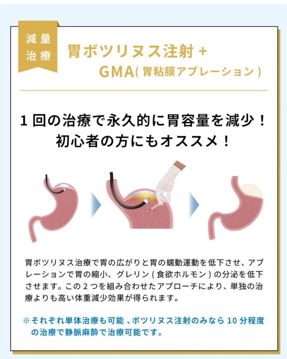 yoshikawachie's tweet photo. え、、！？
今広告に出てきたんだけど
胃にボトックス打てるの？？
これで食欲減少して
ダイエット出来るなら凄くない？
マンジャロいらんやん！！
気になる。。 https://t.co/QKEjQDy1OL