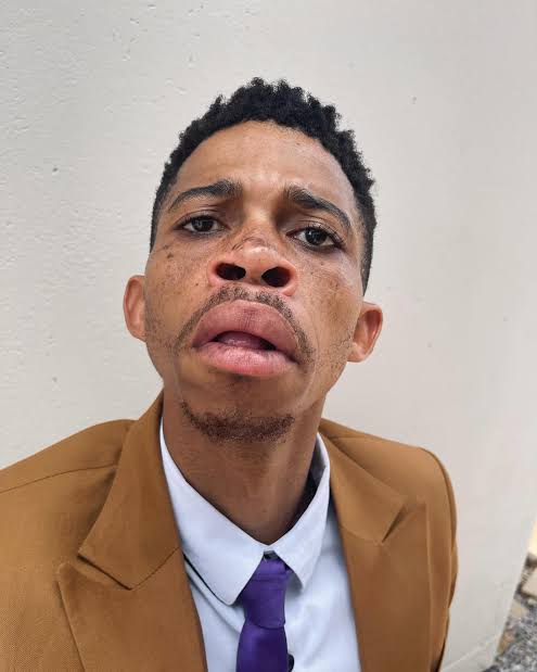 Now in yumbe, we call pork catholic goat for safety purposes🫠