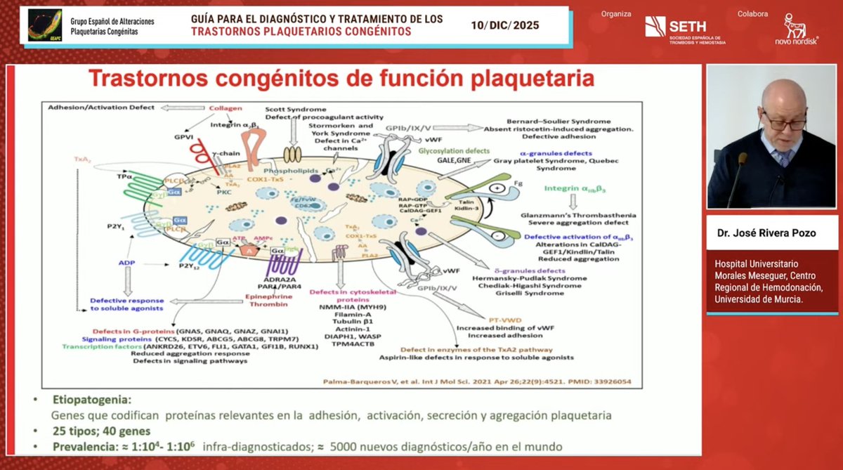 SETH__Oficial's tweet photo. @Malvarezroman @GEAPC1 🗣️Clasificación de los Trastornos Plaquetarios Congénitos y recomendaciones para el diagnóstico.
👩‍⚕️@JosRiveraPozo2, @crh_MoralesIMIB, @IMIB_RMurcia, @dgenesmurcia

▶️Sigue el directo en el canal de Youtube de la SETH👇
https://t.co/9sG1rXBDXv https://t.co/UdM6uPyRn7