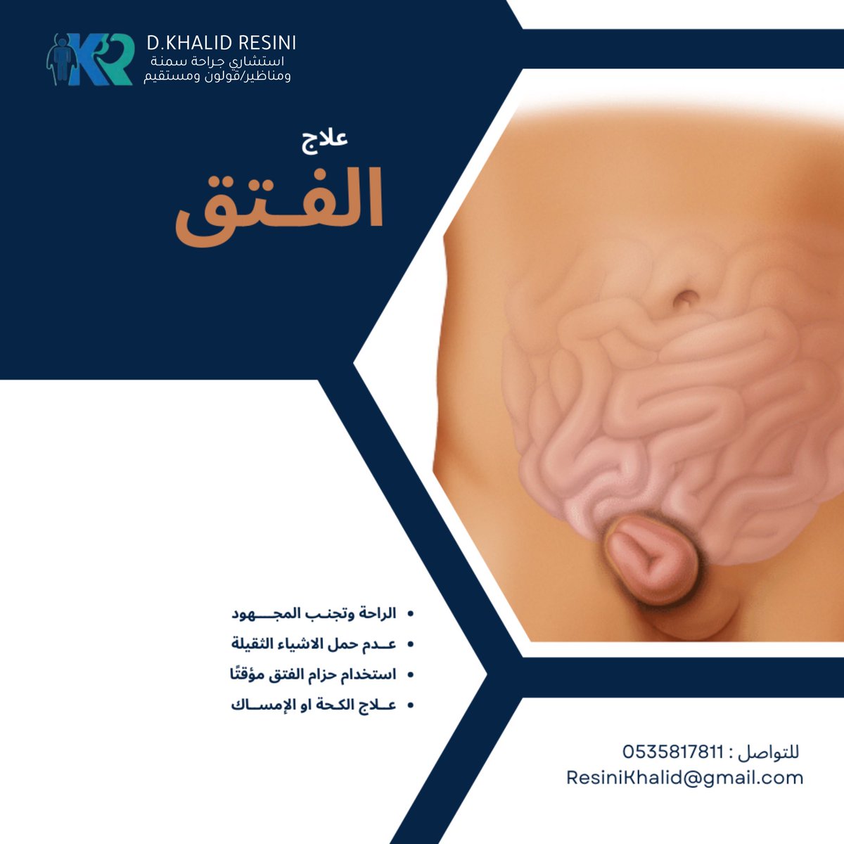 عـلاج الفـتق