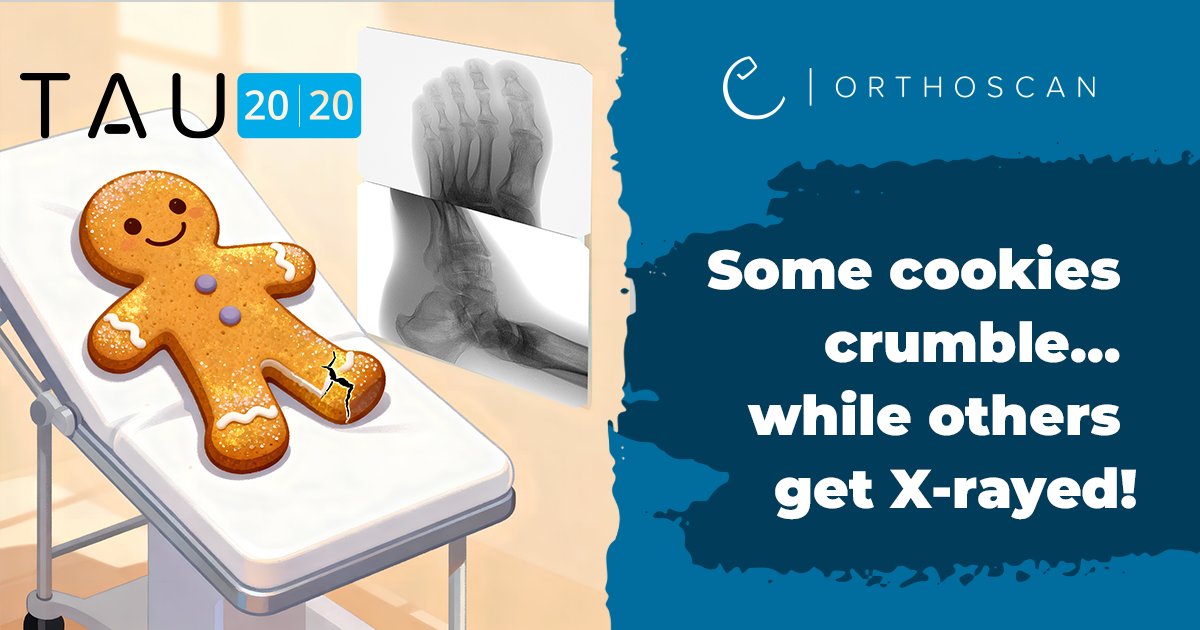 OrthoscanInc's tweet image. He ran from @OrthoscanInc’s oven too fast… luckily the TAU 2020 sees all while keeping our gingerbread man in one piece🦴🦶🍪 Secure next-level imaging like the TAU 2020 today! #MiniCArm #Orthopedics #Imaging #Healthcare #MedicalTechnology #TAU2020