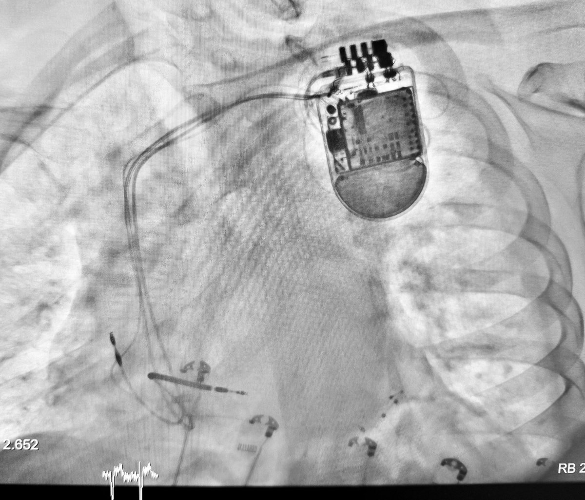 𝙻𝚊𝚒𝚕𝚊 𝙶 𝙼𝚎𝚕𝚌𝚑𝚘𝚛 tweet media