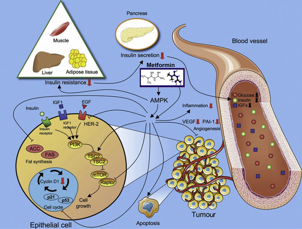 AJOG Expert Review: Metformin, the aspirin of the 21st century: its role in gestational diabetes mellitus, prevention of preeclampsia and cancer, and the promotion of longevity - Different effects of metformin and its signaling pathways ajog.org/article/S0002-…